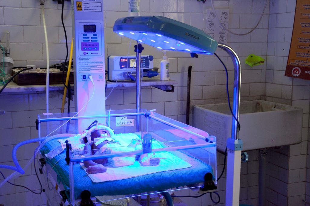 Phototherapy for Newborn Jaundice